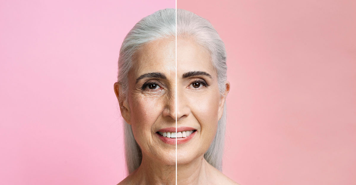 Anti-aging Facials in Surrey